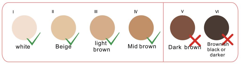 IPL hair removal skin colour chart